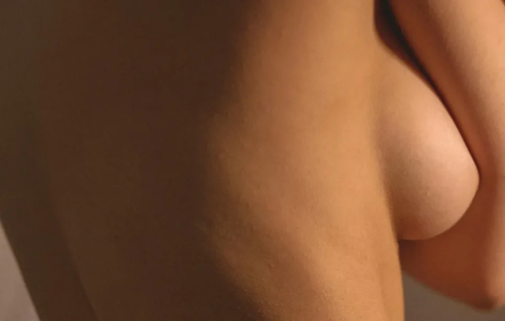 ¿Por qué es tan famoso el mommy makeover?